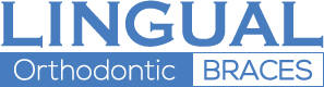 Lingual Orthodontic Braces Ireland Logo